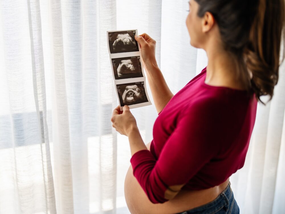 Pregnant woman with ultrasound baby image. Pregnancy, gynecology, medical test, maternal health.